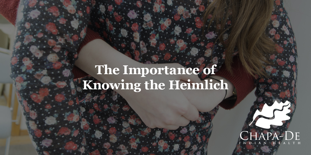 The Importance of Knowing the Heimlich Chapa-De Indian Health Auburn Grass Valley | Medical Clinic