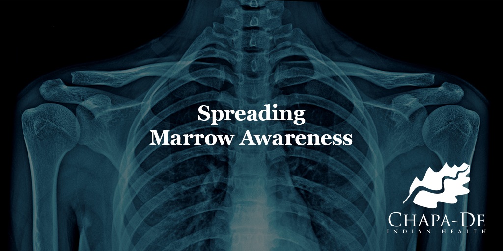 Spreading Marrow Awareness Chapa-De Indian Health Auburn Grass Valley | Medical Clinic
