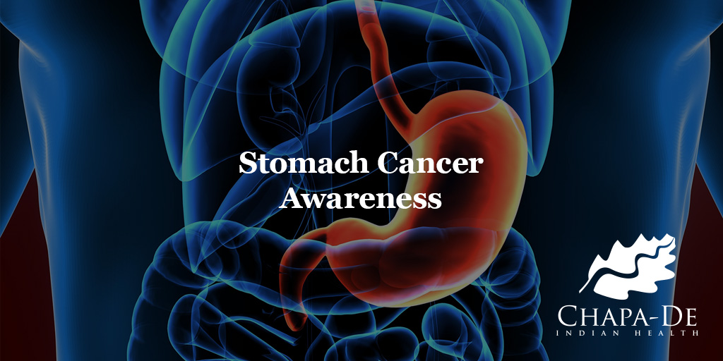 Stomach Cancer Awareness Chapa-De Indian Health Auburn Grass Valley | Medical Clinic