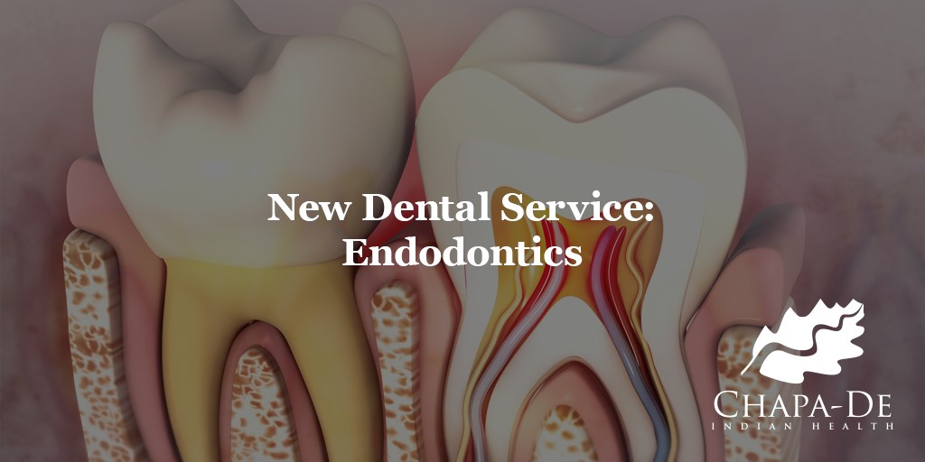 Endodontics New Dental Service Chapa-De Indian Health Auburn Grass Valley | Medical Clinic